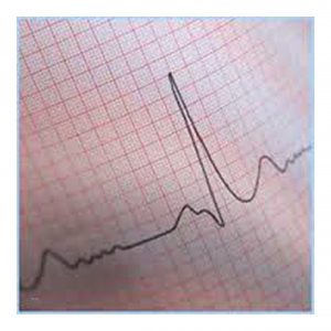 ECG Graph Paper Rolls